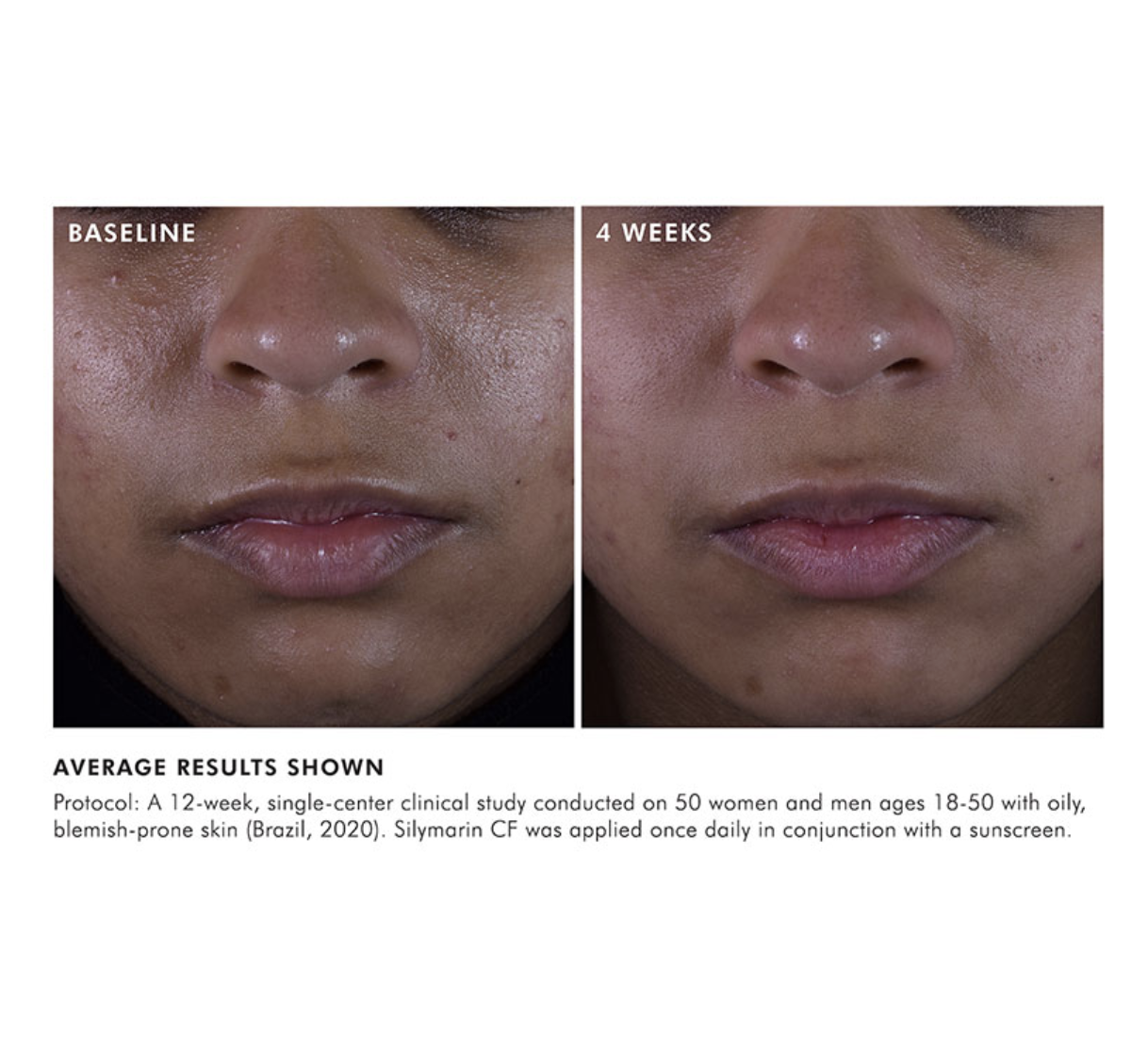 Silymarin CF Results