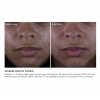 Silymarin CF Results